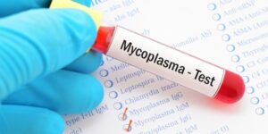 micoplasma test