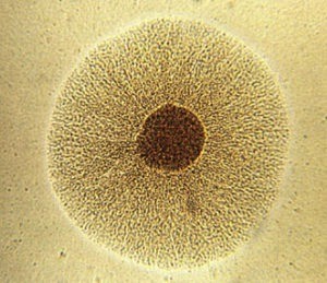 mycoplasma hominis colonia 300x259 1